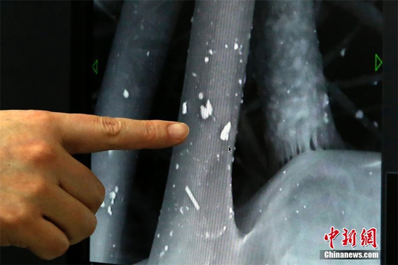 Schwerer Smog lastet weiter auf chinesischen St?dten